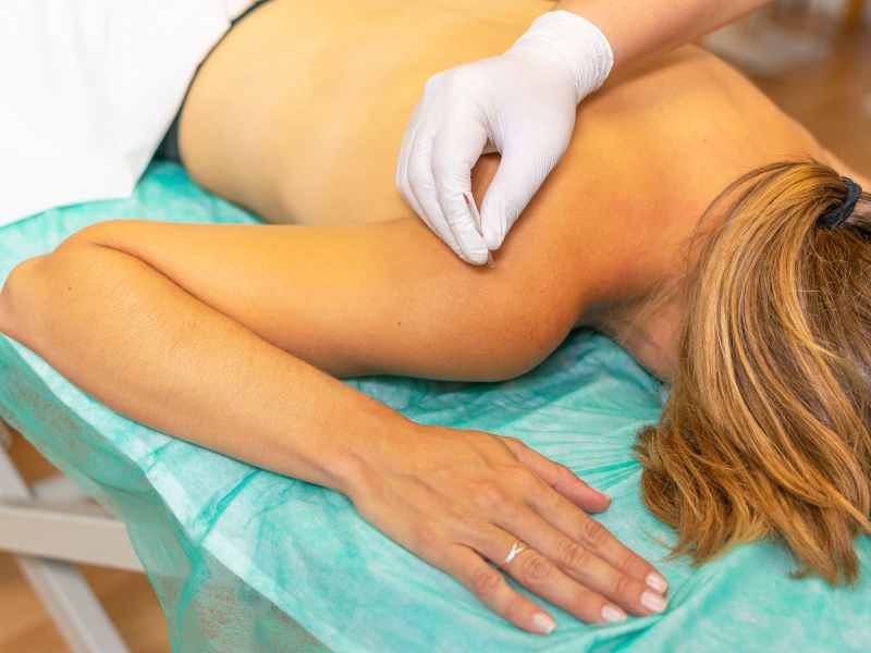 Dry needling therapy for pain relief in Jaipur